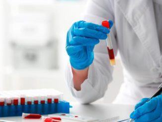 Covid Assisi, 16 in più i casi positivi rispetto a ieri, 527 in totale