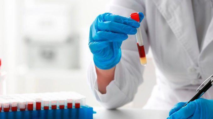 Covid Assisi, 16 in più i casi positivi rispetto a ieri, 527 in totale